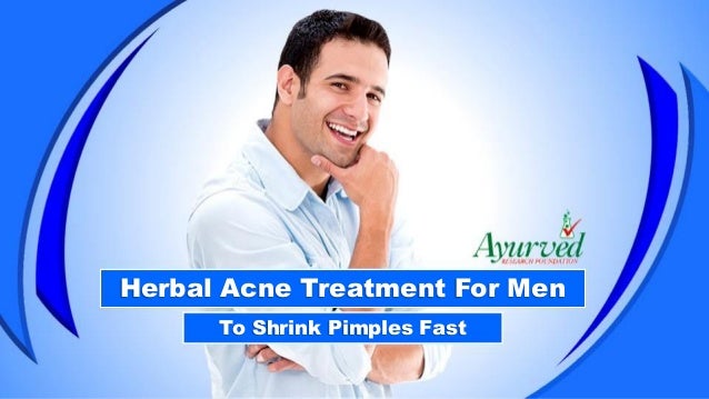 herbal acne treatment