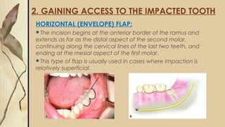 2. GAINING ACCESS TO THE IMPACTED TOOTH
HORIZONTAL (ENVELOPE) FLAP:
The incision begins at the anterior border of the ramus and
extends as far as the distal aspect of the second molar,
continuing along the cervical lines of the last two teeth, and
ending at the mesial aspect of the first molar.
This type of flap is usually used in cases where impaction is
relatively superficial.
 