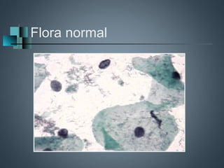 Flora normal
 