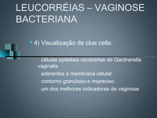 LEUCORRÉIAS – VAGINOSE
BACTERIANA

     4) Visualização de clue cells:

        células epiteliais recobertas de Gardnerella
       vaginalis
        aderentes à membrana celular

        contorno granuloso e impreciso

       
         um dos melhores indicadores de vaginose
 