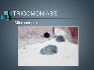 TRICOMONÍASE
Microscopia
 