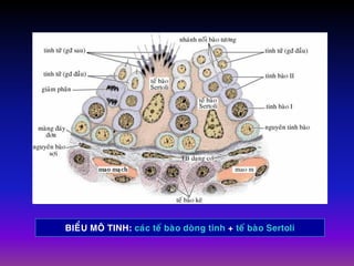 BIEÅU MOÂ TINH: caùc teá baøo doøng tinh + teá baøo Sertoli
 