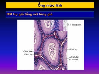 OÁng maøo tinh
BM truï giaû taàng vôùi loâng giaû
 