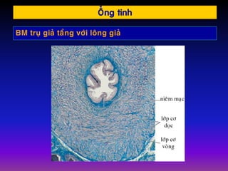 OÁng tinh
BM truï giaû taàng vôùi loâng giaû
 