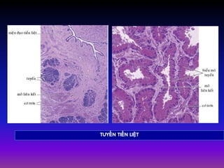 TUYEÁN TIEÀN LIEÄT
 