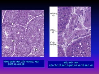 OÁNG SINH TINH CAÉT NGANG, XEN
GIÖÕA LAØ MOÂ KEÕ
BIEÅU MOÂ TINH
VÔÙI CAÙC TEÁ BAØO DAÏNG CÔ VAØ TEÁ BAØO KEÕ
 