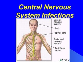 Central Nervous System Infections 