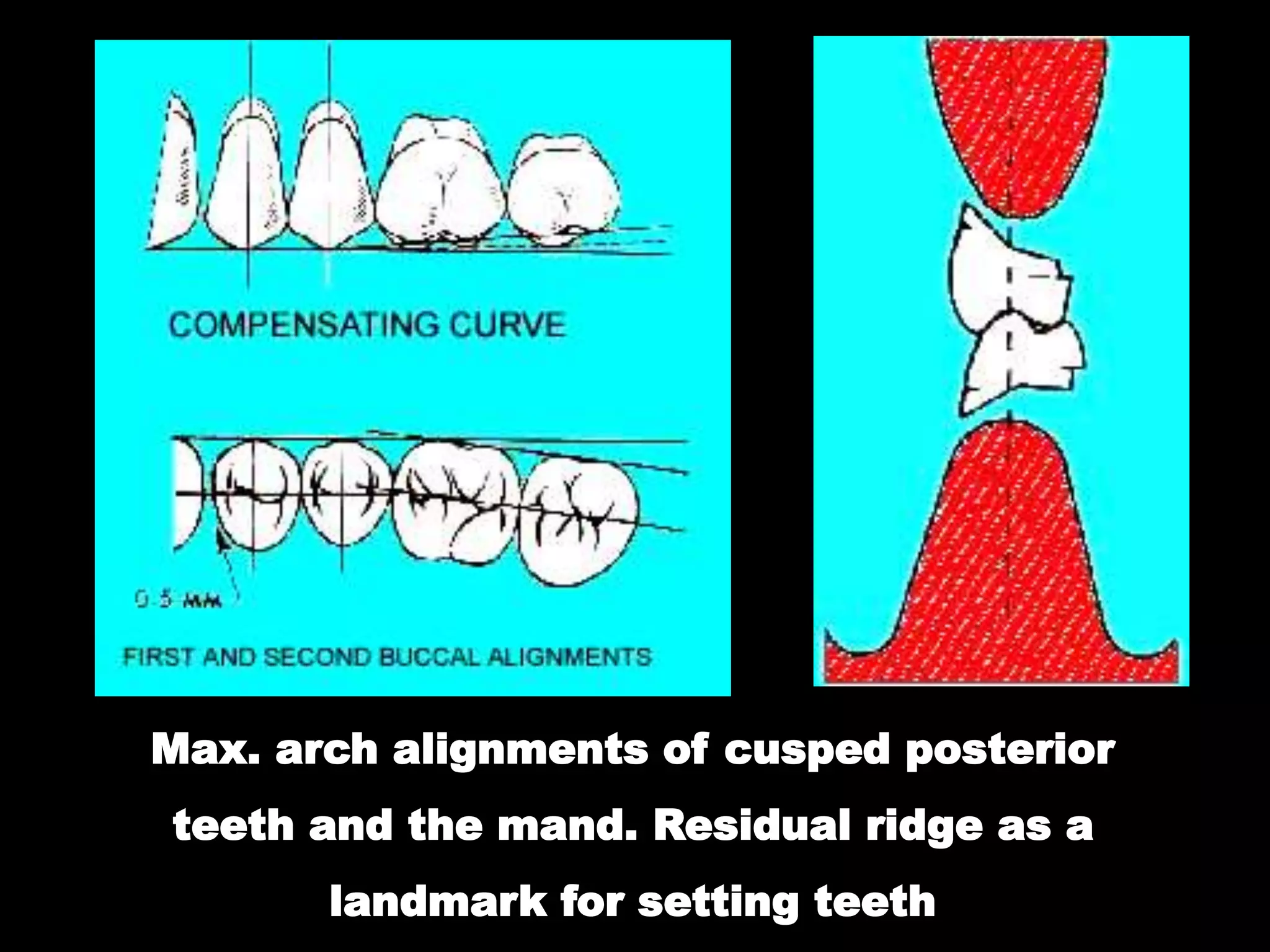 Posterior Ridge 04- Occlusion in prosthodontics- Concepts of occlusion.ppt