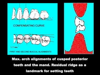 04- Occlusion in prosthodontics- Concepts of occlusion.ppt