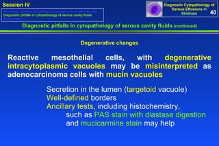Diagnostic pitfalls in cytopathology of serous cavity fluids  (continued) Degenerative changes Reactive mesothelial cells, with  degenerative intracytoplasmic vacuoles  may be  misinterpreted  as adenocarcinoma cells with  mucin vacuoles   Secretion in the lumen ( targetoid  vacuole) Well-defined  borders  Ancillary tests , including histochemistry,  such as  PAS stain with diastase digestion   and  mucicarmine stain  may help 40 Washings, lavages, brushings, scrapings, and touch imprints Diagnostic pitfalls in cytopathology of serous cavity fluids Study cases 