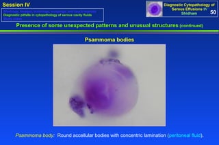 Presence of some unexpected patterns and unusual structures  (continued) Psammoma bodies Psammoma body :  Round accellular bodies with concentric lamination ( peritoneal fluid ). 50 Washings, lavages, brushings, scrapings, and touch imprints Diagnostic pitfalls in cytopathology of serous cavity fluids Study cases 
