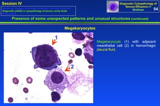 Megakaryocyte  (1) with adjacent mesothelial cell (2) in hemorrhagic  pleural fluid .  2 1 Presence of some unexpected patterns and unusual structures  (continued) Megakaryocytes 54 Washings, lavages, brushings, scrapings, and touch imprints Diagnostic pitfalls in cytopathology of serous cavity fluids Study cases 