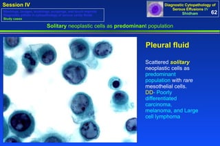Scattered   solitary   neoplastic cells as  predominant population  with  rare  mesothelial cells. DD - Poorly differentiated carcinoma, melanoma, and Large cell lymphoma Pleural fluid   Solitary  neoplastic cells as  predominan t population 62 Washings, lavages, brushings, scrapings, and touch imprints Diagnostic pitfalls in cytopathology of serous cavity fluids Study cases 