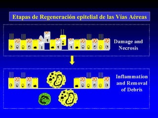 Etapas de Regeneración epitelial de las Vías Aéreas
 