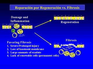 Reparación por Regeneración vs. Fibrosis
 