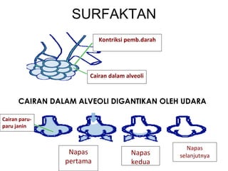 SURFAKTAN Cairan dalam alveoli Kontriksi pemb.darah CAIRAN DALAM ALVEOLI DIGANTIKAN OLEH UDARA Cairan par u- paru janin Napas pertama Napas kedua Napas selanjutnya 