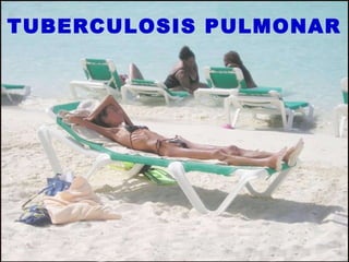 TUBERCULOSIS PULMONAR 