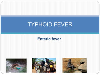 Enteric fever
TYPHOID FEVER
 