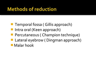  Temporal fossa ( Gillis approach)
 Intra oral (Keen approach)
 Percutaneous ( Champion technique)
 Lateral eyebrow ( Dingman approach)
 Malar hook
 