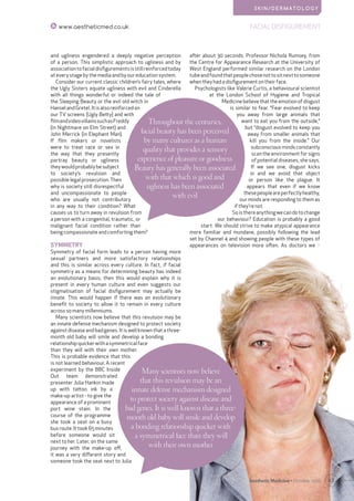 43Aesthetic Medicine • October 2016
FACIAL DISFIGUREMENTwww.aestheticmed.co.uk
S K I N / D E R M AT O L O G Y
and ugliness engendered a deeply negative perception
of a person. This simplistic approach to ugliness and by
associationtofacialdisfigurementsisstillreinforcedtoday
at every stage by the media and by our education system.
Consider our current classic children’s fairy tales, where
the Ugly Sisters equate ugliness with evil and Cinderella
with all things wonderful or indeed the tale of
the Sleeping Beauty or the evil old witch in
HanselandGretel.Itisalsoreinforcedon
our TV screens (Ugly Betty) and with
filmandvideovillainssuchasFreddy
(in Nightmare on Elm Street) and
John Merrick (in Elephant Man).
If film makers or novelists
were to treat race or sex in
the way that they presently
portray beauty or ugliness
they would probably be subject
to society’s revulsion and
possible legal prosecution. Then
why is society still disrespectful
and uncompassionate to people
who are usually not contributory
in any way to their condition? What
causes us to turn away in revulsion from
a person with a congenital, traumatic, or
malignant facial condition rather than
being compassionate and comforting them?
SYMMETRY
Symmetry of facial form leads to a person having more
sexual partners and more satisfactory relationships
and this is similar across every culture. In fact, if facial
symmetry as a means for determining beauty has indeed
an evolutionary basis, then this would explain why it is
present in every human culture and even suggests our
stigmatisation of facial disfigurement may actually be
innate. This would happen if there was an evolutionary
benefit to society to allow it to remain in every culture
across so many millenniums.
Many scientists now believe that this revulsion may be
an innate defense mechanism designed to protect society
against disease and bad genes. It is well known that a three-
month old baby will smile and develop a bonding
relationshipquickerwithasymmetricalface
than they will with their own mother.
This is probable evidence that this
is not learned behaviour. A recent
experiment by the BBC Inside
Out team demonstrated
presenter Julia Hankin made
up with tattoo ink by a
make-up artist - to give the
appearance of a prominent
port wine stain. In the
course of the programme
she took a seat on a busy
busroute.Ittook65minutes
before someone would sit
next to her. Later, on the same
journey with the make-up off,
it was a very different story and
someone took the seat next to Julia
after about 30 seconds. Professor Nichola Rumsey, from
the Centre for Appearance Research at the University of
West England performed similar research on the London
tubeandfoundthatpeoplechosenottositnexttosomeone
when they had a disfigurement on their face.
Psychologists like Valerie Curtis, a behavioural scientist
at the London School of Hygiene and Tropical
Medicine believe that the emotion of disgust
is similar to fear. “Fear evolved to keep
you away from large animals that
want to eat you from the outside,”
but “disgust evolved to keep you
away from smaller animals that
kill you from the inside.” Our
subconscious minds constantly
scan the environment for signs
of potential diseases, she says.
If we see one, disgust kicks
in and we avoid that object
or person like the plague. It
appears that even if we know
thesepeopleareperfectlyhealthy,
our minds are responding to them as
if they’re not.
Soisthereanythingwecandotochange
our behaviour? Education is probably a good
start. We should strive to make atypical appearance
more familiar and mundane, possibly following the lead
set by Channel 4 and showing people with these types of
appearances on television more often. As doctors we >
Many scientists now believe
that this revulsion may be an
innate defense mechanism designed
to protect society against disease and
bad genes. It is well known that a three-
month old baby will smile and develop
a bonding relationship quicker with
a symmetrical face than they will
with their own mother
Throughout the centuries,
facial beauty has been perceived
by many cultures as a human
quality that provides a sensory
experience of pleasure or goodness.
Beauty has generally been associated
with that which is good and
ugliness has been associated
with evil
 