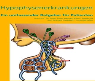 04.11 Hypophysenerkrankungen. Ratgeber für Patienten bei Hypophysenerkrankungen.
