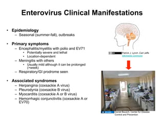 Enterovirus Clinical Manifestations

•  Epidemiology
   –  Seasonal (summer-fall), outbreaks

•  Primary symptoms
   –  Encephalitis/myelitis with polio and EV71
          •  Potentially severe and lethal                     Patrick J. Lynch ,Carl Jaffe
          •  Location-dependent                                wikimedia commons

   –  Meningitis with others
          •  Usually mild although it can be prolonged
             (>week)
   –  Respiratory/GI prodrome seen

•  Associated syndromes
   –    Herpangina (coxsackie A virus)
   –    Pleurodynia (coxsackie B virus)
   –    Myocarditis (coxsackie A or B virus)
   –    Hemorrhagic conjunctivitis (coxsackie A or
        EV70)

                                                         Daniel Bausch, Center for Disease
                                                         Control and Prevention
 