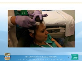 Continuous Video EEG Monitoring | PPTX