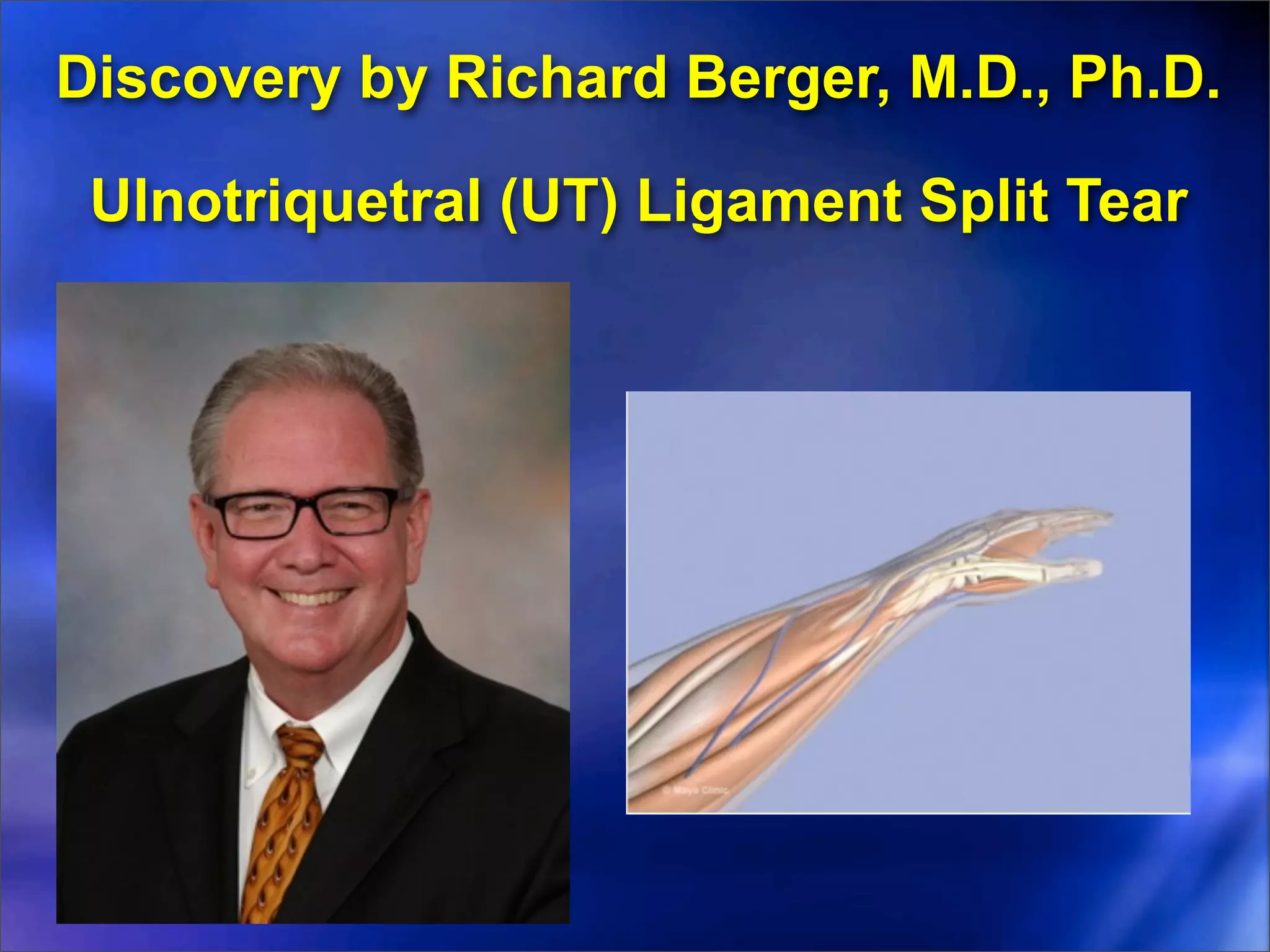 Discovery by Richard Berger, M.D., Ph.D.

 Ulnotriquetral (UT) Ligament Split Tear
 