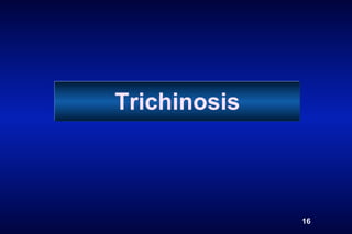 Trichinosis



              16
 
