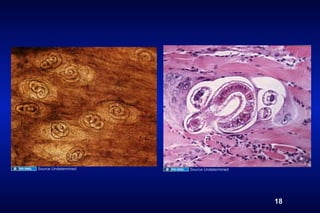 Source Undetermined   Source Undetermined




                                            18
 