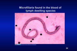 Microfiliaria found in the blood of
     lymph dwelling species




 Armed Forces Institute of Pathology



                                       24
 