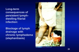 Long-term
consequences of
persistent lymph-
dwelling filarial
infection:

Blockage of lymph
drainage with
chronic lymphedema
(elephantiasis)


                     Source Undetermined

                                           25
 