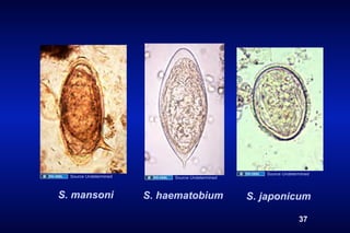 Source Undetermined
  Source Undetermined        Source Undetermined



S. mansoni              S. haematobium             S. japonicum

                                                                    37
 