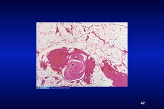 Source Undetermined




                      42
 