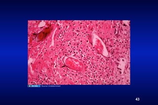 Source Undetermined




                      43
 