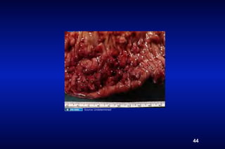 Source Undetermined




                      44
 