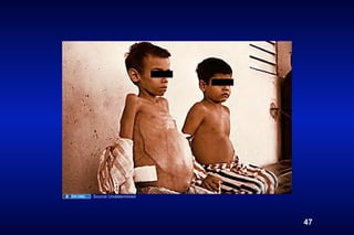 Source Undetermined




                      47
 