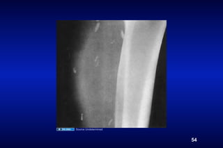 Source Undetermined



                      54
 