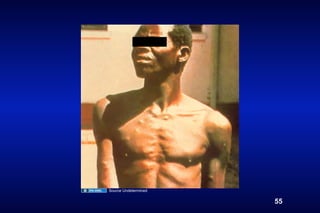 Source Undetermined

                      55
 