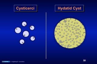 Cysticerci         Hydatid Cyst




C. Engleberg/V. Carruthers
                                            58
 