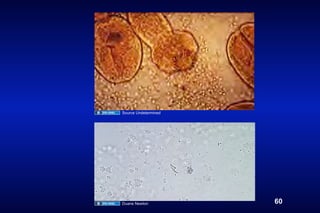 Source Undetermined




Duane Newton          60
 