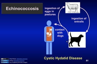 Echinococcosis                       ingestion of
                                     eggs in
                                     pastures
                                                       ingestion of
                                                         entrails


                                             contact
                                              with
                                              dogs




 (dog) Abujoy, wikimedia commons     Cystic Hydatid Disease
 (sheep) wikimedia commons                                        61
 Cary Engleberg (All other images)
 