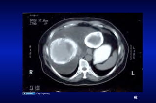 Cary Engleberg

                 62
 