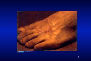 Cary Engleberg



                 7
 