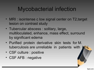 Mycobacterial infection
• MRI : isointense c low signal center on T2,target
lesion on contrast study
• Tubercular abscess : solitary, large,
multiloculated, enhance, mass effect, surround
by significant edema
• Purified protein derivative skin tests for M.
tuberculosis are unreliable in patients with HIV
• CSF culture : positive
• CSF AFB : negative
 