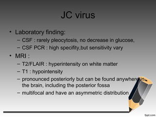 JC virus
• Laboratory finding:
– CSF : rarely pleocytosis, no decrease in glucose,
– CSF PCR : high specifity,but sensitivity vary
• MRI :
– T2/FLAIR : hyperintensity on white matter
– T1 : hypointensity
– pronounced posteriorly but can be found anywhere in
the brain, including the posterior fossa
– multifocal and have an asymmetric distribution
 