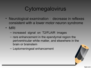 Cytomegalovirus
• Neurological examination : decrease in reflexes
consistent with a lower motor neuron syndrome
• MRI
– increased signal on T2/FLAIR images
– rare enhancement in the ependymal region the
periventricular white matter, and elsewhere in the
brain or brainstem
– Leptomeningeal enhancement
 
