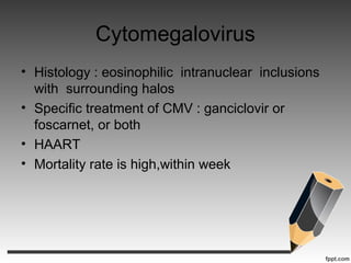 Cytomegalovirus
• Histology : eosinophilic intranuclear inclusions
with surrounding halos
• Specific treatment of CMV : ganciclovir or
foscarnet, or both
• HAART
• Mortality rate is high,within week
 