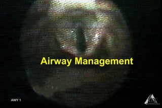 AWY 1
®
Airway Management
AWY 1
®
 