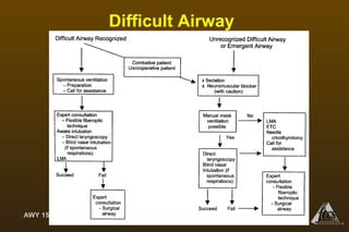 AWY 15
®
Difficult Airway
 